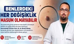 Benlerdeki Her Değişiklik Masum Olmayabilir