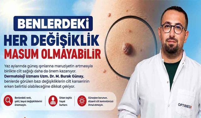 Benlerdeki Her Değişiklik Masum Olmayabilir